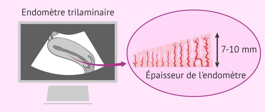 ndomètre, utérus, vagin, femme, labosalem, laboratoires salem