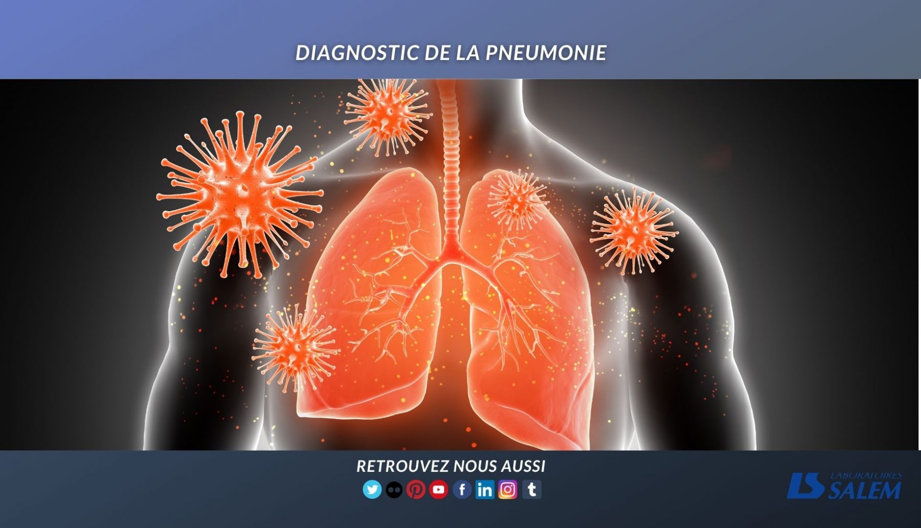 covid19, diagnostic de pneumologie, pneumologie, labosalem